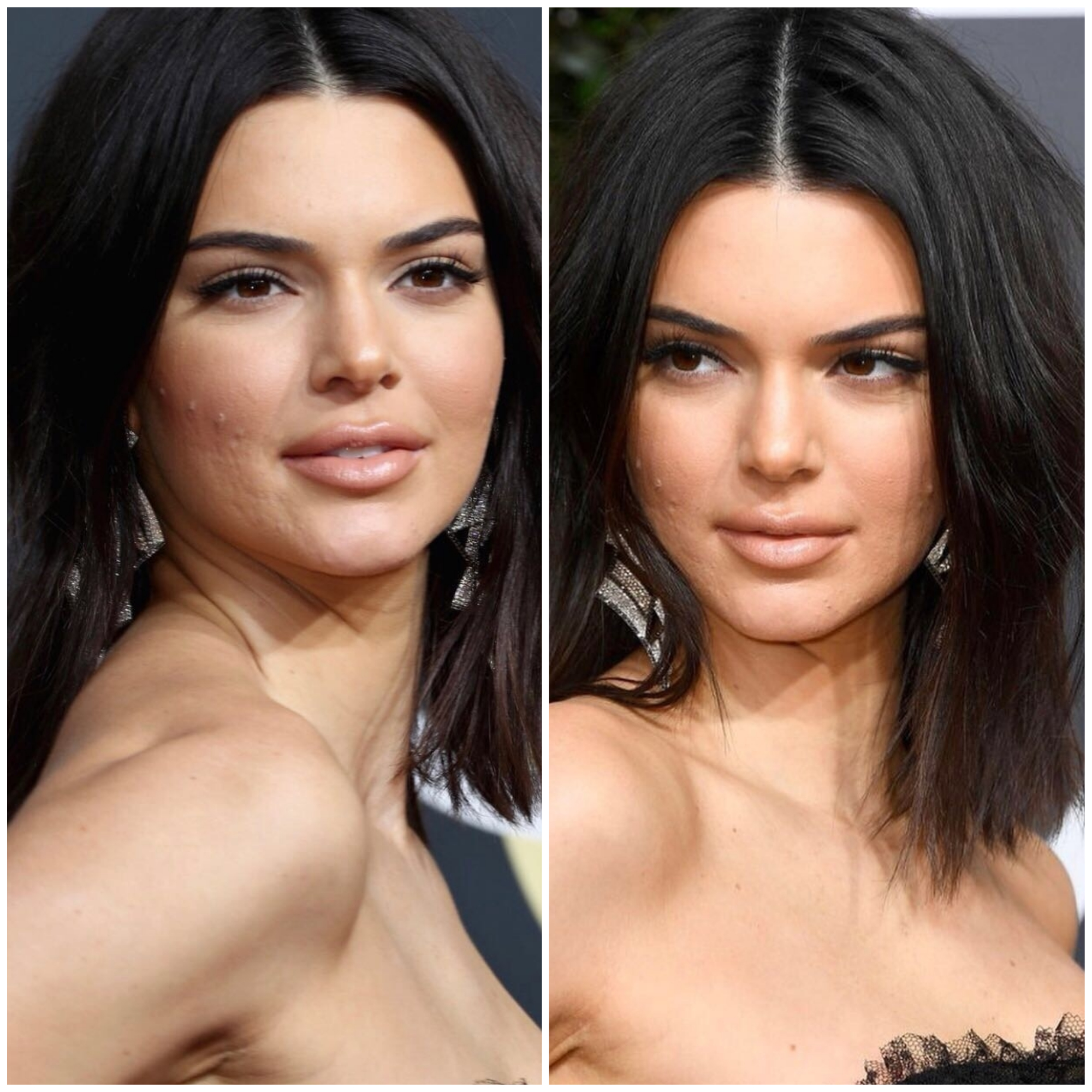 Kendall Jenner : moquée à cause de son acné aux Golden Globes, elle répond aux critiques !
