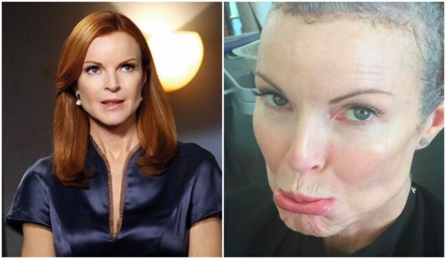 Marcia Cross (Desperate Housewives) : elle raconte son combat contre le cancer