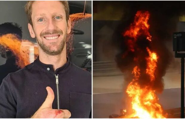 Romain Grosjean : il montre ses brûlures en dévoilant sa main sa bandages