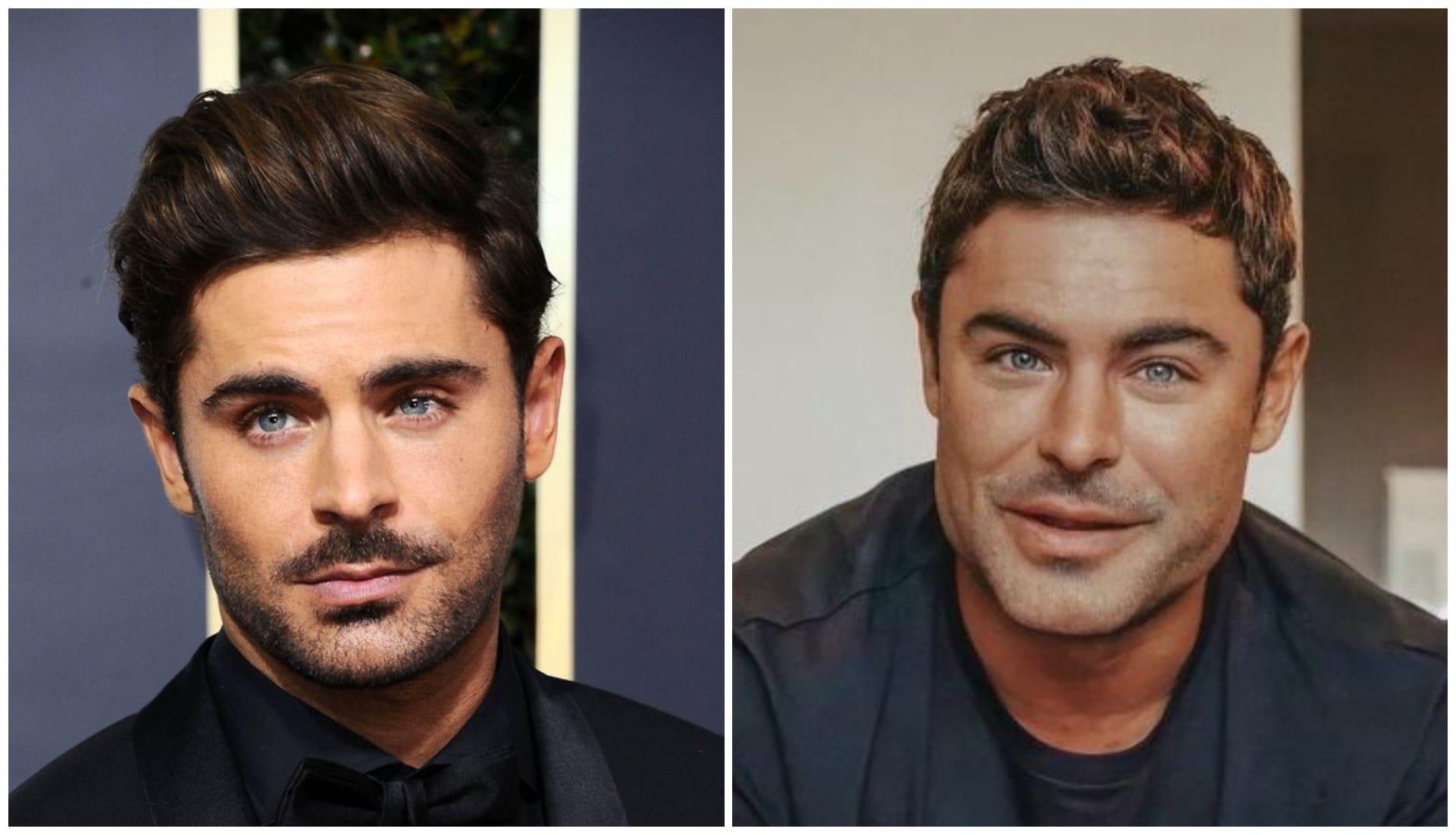 Zac Efron méconnaissable : a-t-il abusé du bistouri ? Un chirurgien prend la parole