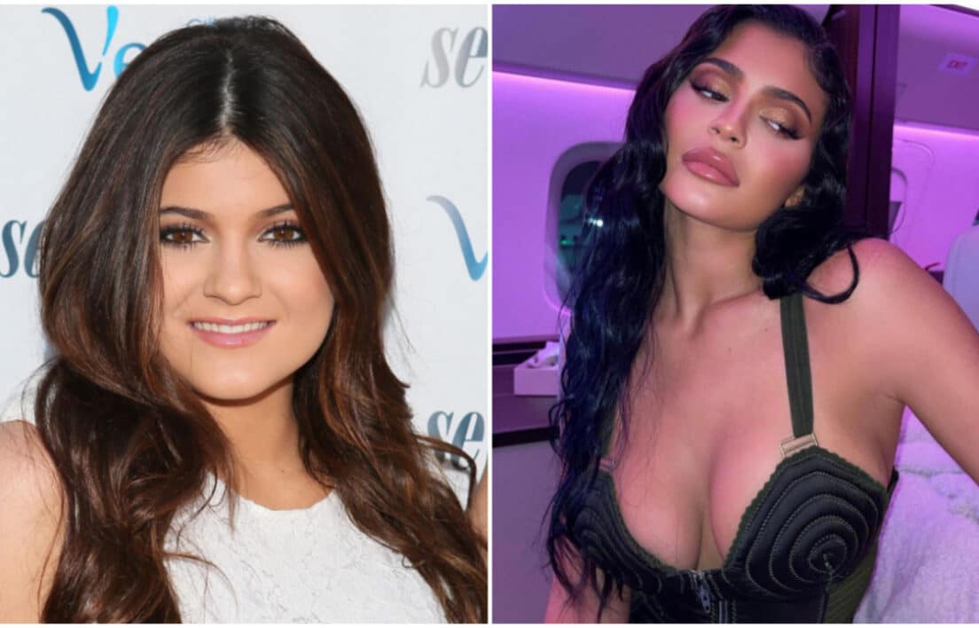 Kylie Jenner : elle explique pourquoi elle a fait refaire ses lèvres
