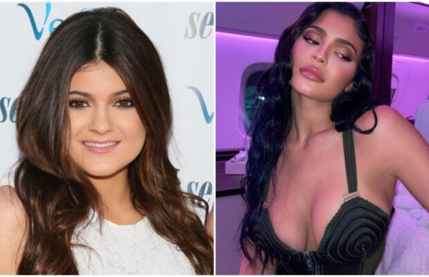 Kylie Jenner : elle explique pourquoi elle a fait refaire ses lèvres