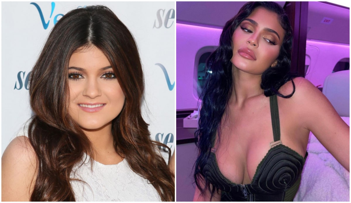 Kylie Jenner : elle explique pourquoi elle a fait refaire ses lèvres