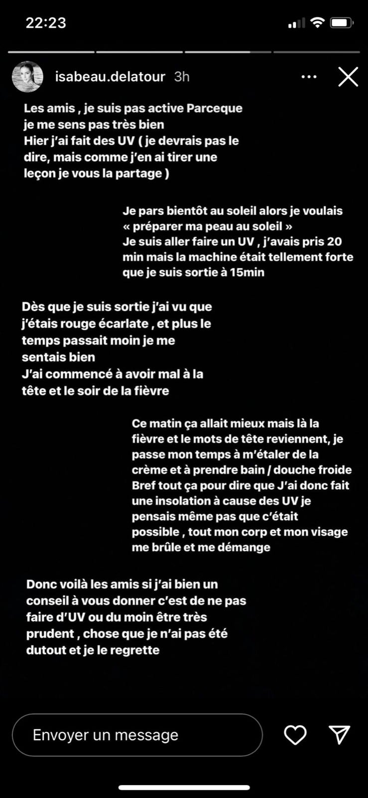 Isabeau : elle se montre défigurée après une séance d'UV qui a mal tourné 