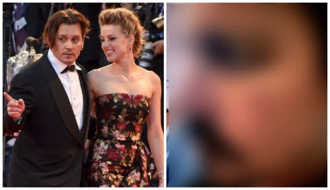 Johnny Depp : violemment agressé par son ex femme Amber Heard ? Des clichés CHOC dévoilés, nouveau témoignage accablant