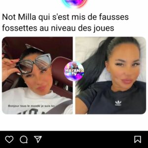 Milla Jasmine : accusée d’avoir eu recours à la chirurgie esthétique en secret