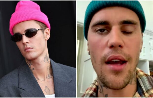 Justin Bieber paralysé du visage : les causes du syndrome de Ramsay Hunt se précisent