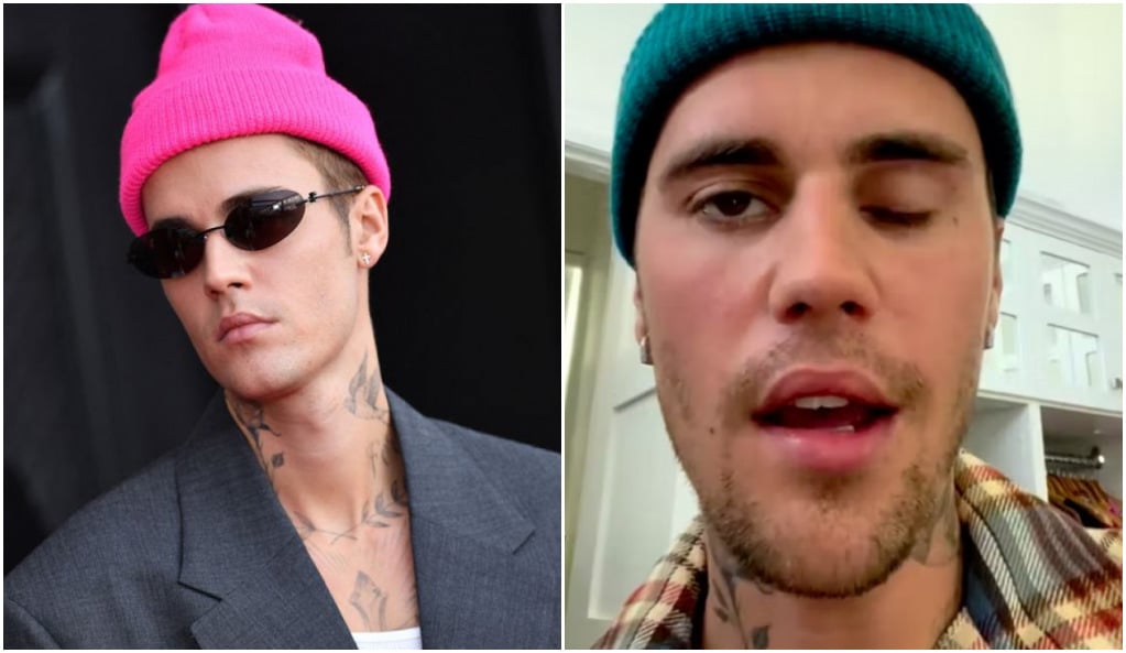 Justin Bieber paralysé du visage : les causes du syndrome de Ramsay Hunt se précisent