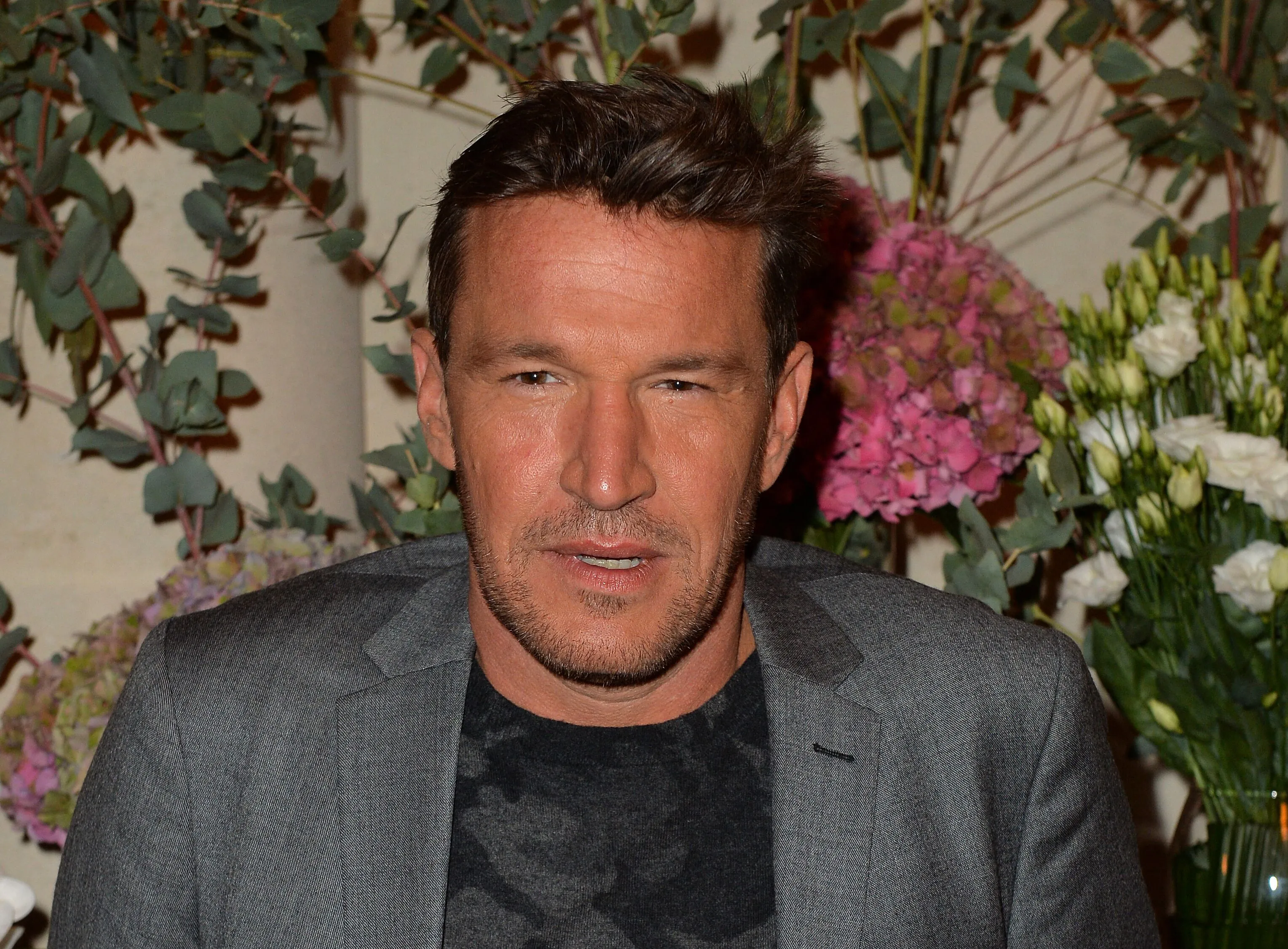 Benjamin Castaldi : il a fait une opération de chirurgie esthétique pour avoir un plus beau sourire