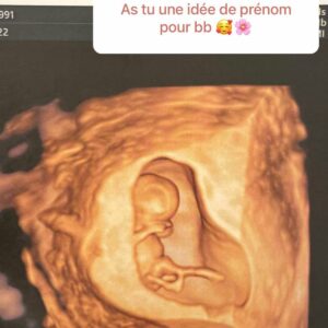 Capucine Anav enceinte : prise de poids, prénom... elle s'exprime sur sa grossesse