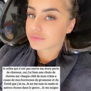 Kamila : victime de perte de cheveux, elle s'exprime