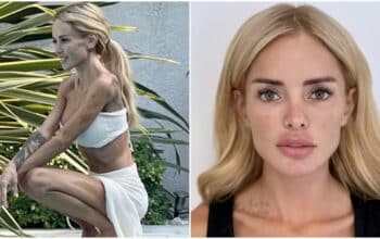 'Je fais 32kg' : Aurélie Preston s'exprime après sa tentative de suicide