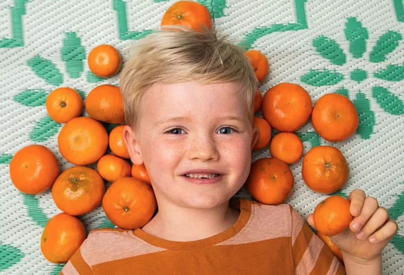 À force de manger trop d'oranges, un enfant se transforme en Simpson