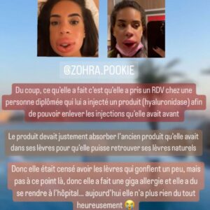 Marwa : défigurée après des injections, elle s'exprime