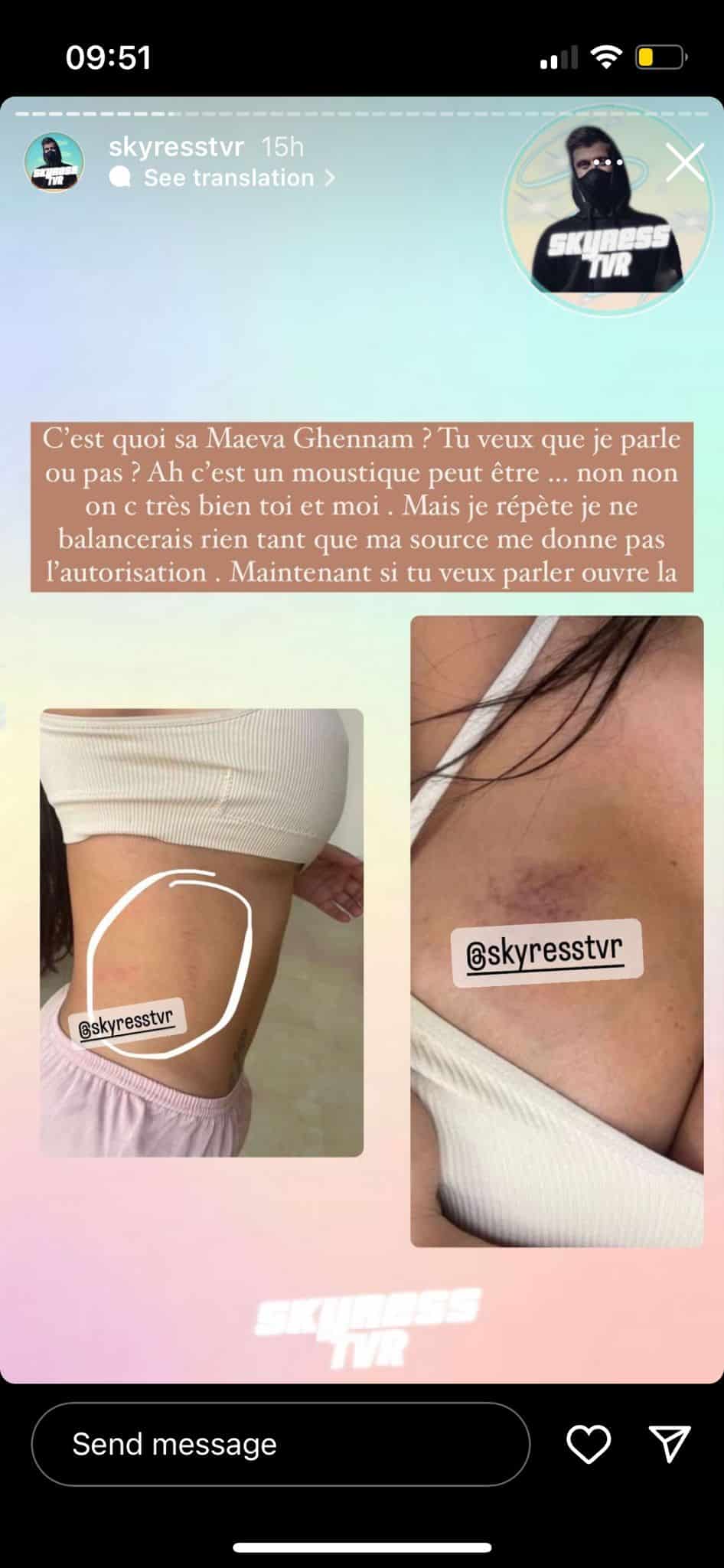 Maeva Ghennam : frappée par son chéri Boli ? Elle s'exprim