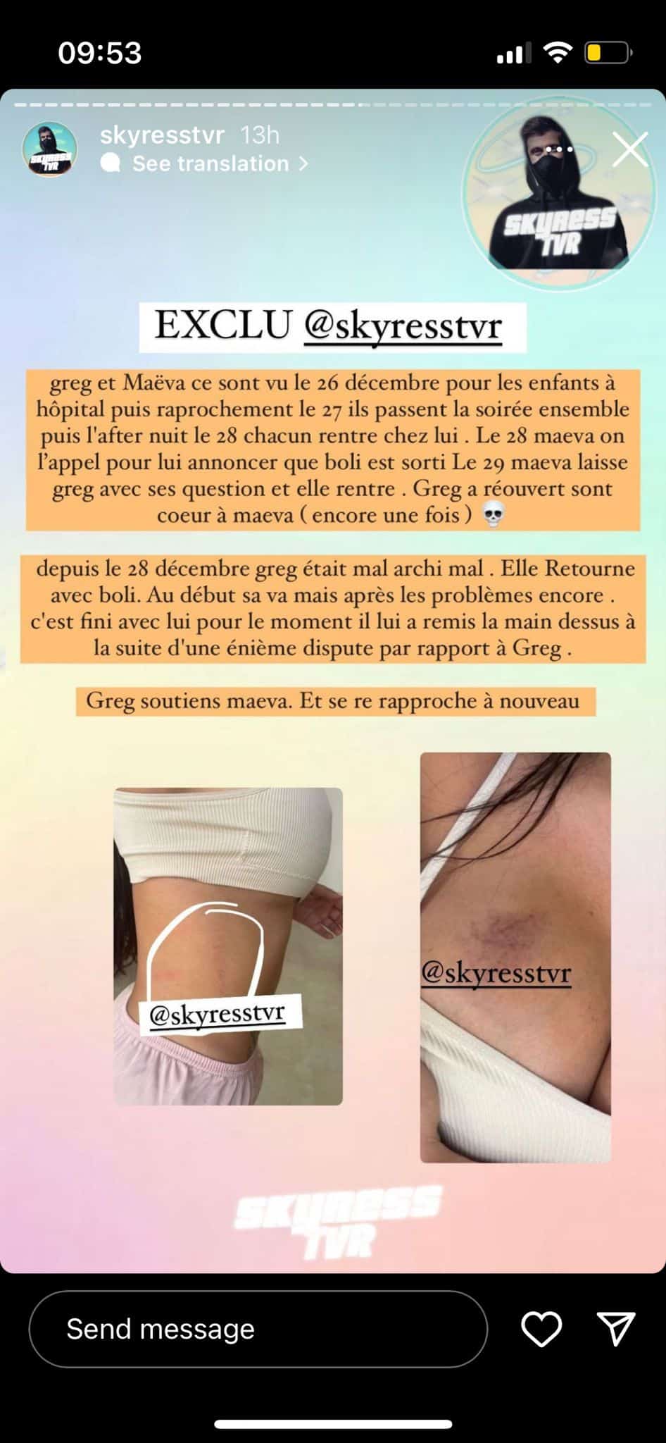 Maeva Ghennam : frappée par son chéri Boli ? Elle s'exprim