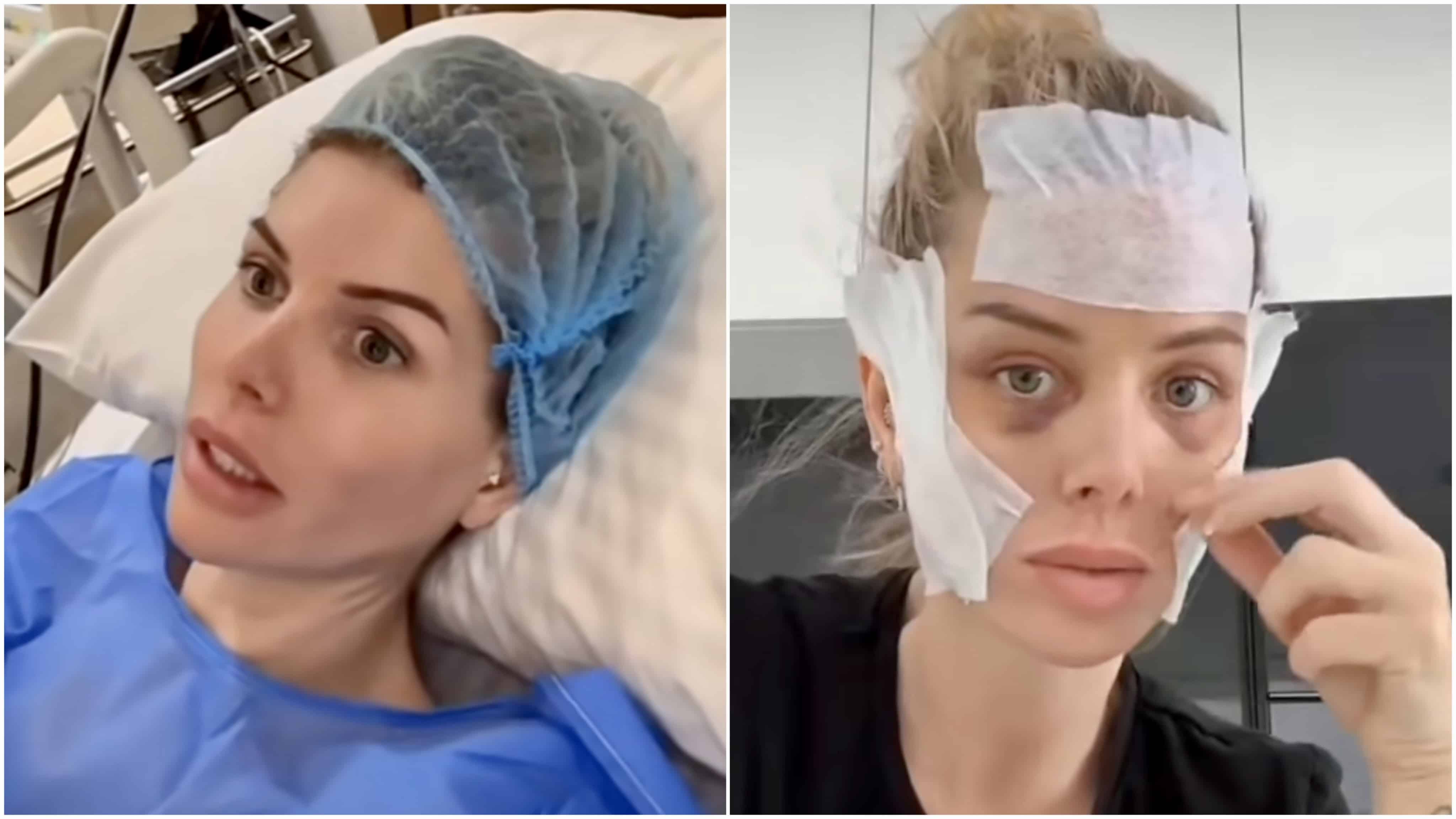Jessica Thivenin : après son opération de chirurgie esthétique, elle montre le résultat