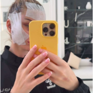 Jessica Thivenin : elle montre son visage sans les bandages après sa nouvelle chirurgie esthétique