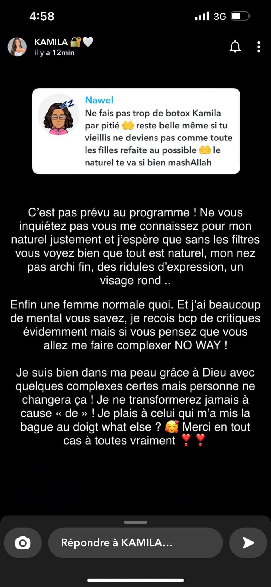 Kamila : sur le point de recourir à la chirurgie esthétique ? Elle s'exprime