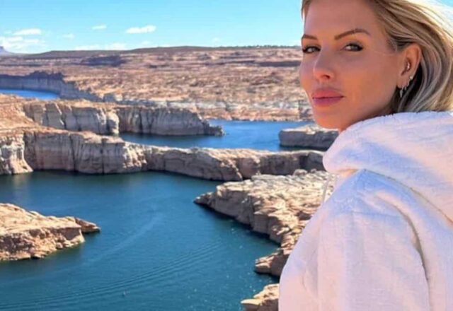 Jessica Thivenin : elle montre son visage sans les bandages après sa nouvelle chirurgie esthétique