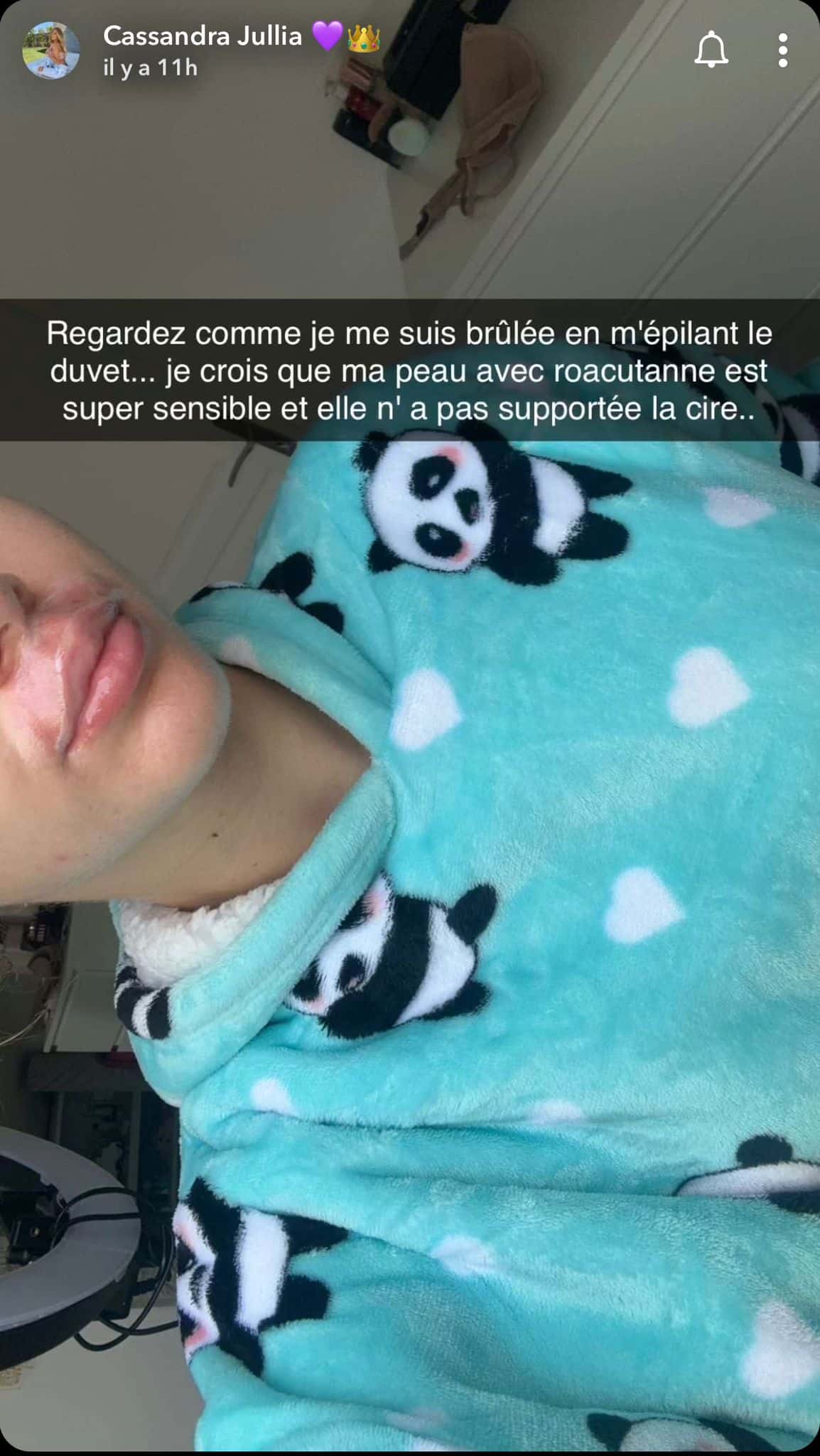 'Je suis bien brûlée' : Cassandra Jullia blessée au visage, elle est au plus mal