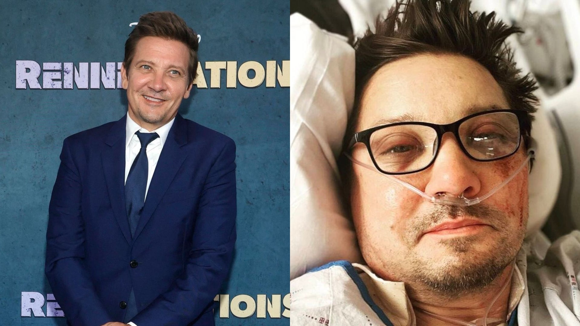 'Mon oeil est sorti' : Jeremy Renner donne des détails sur son grave accident