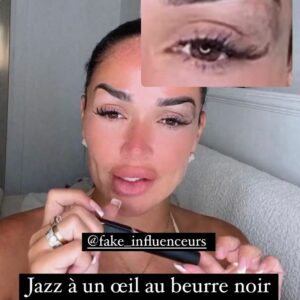 Jazz Correia : un cliché d'elle avec un œil au beurre noir inquiète les internautes