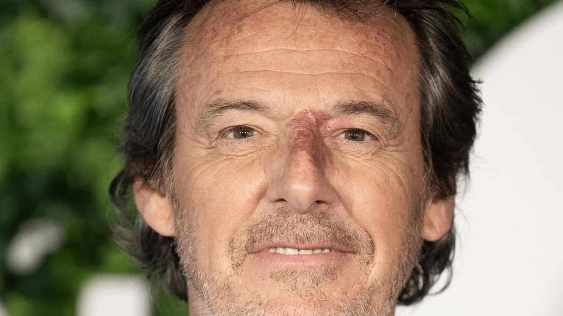 Jean-Luc Reichmann : une caissière lui parle de sa 'tâche sur le nez', la vidéo fait réagir les internautes