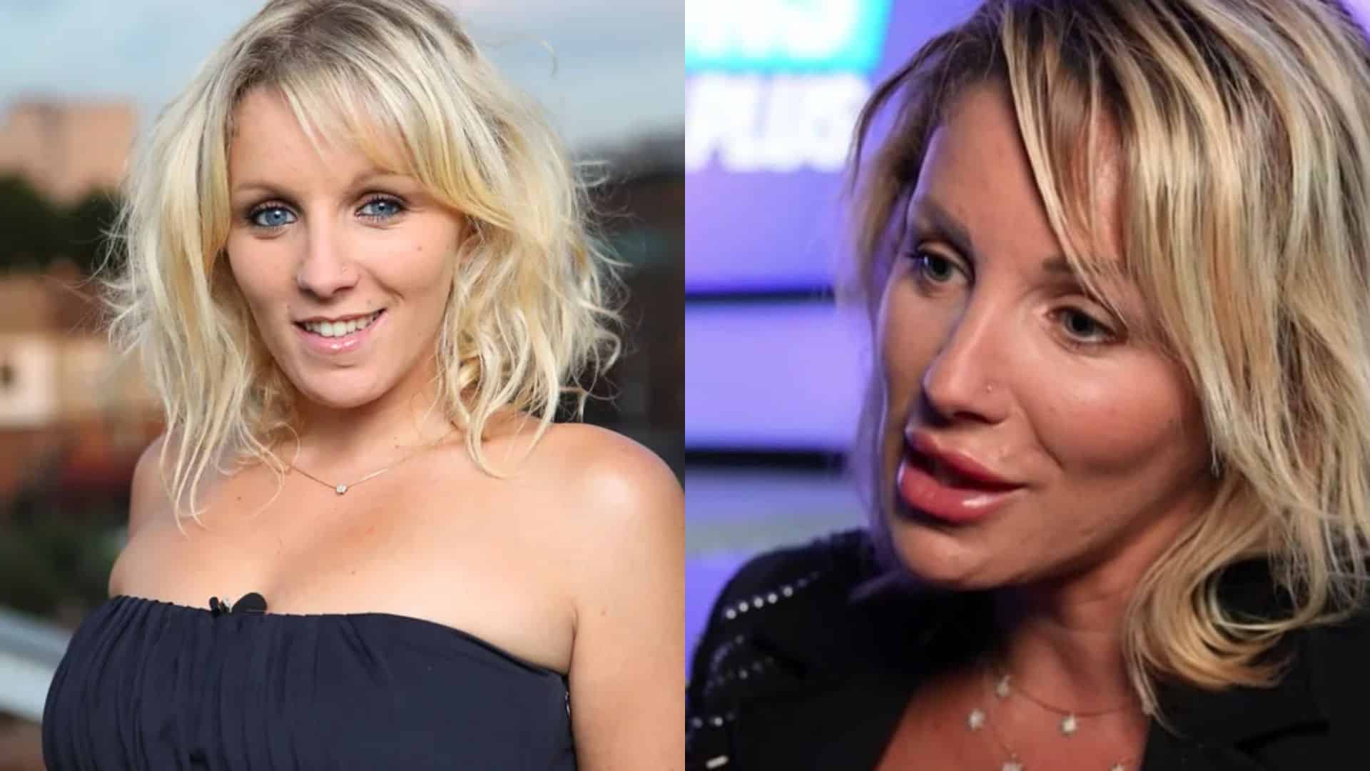 Myriam Abel : son visage métamorphosé par les injections , elle veut agir