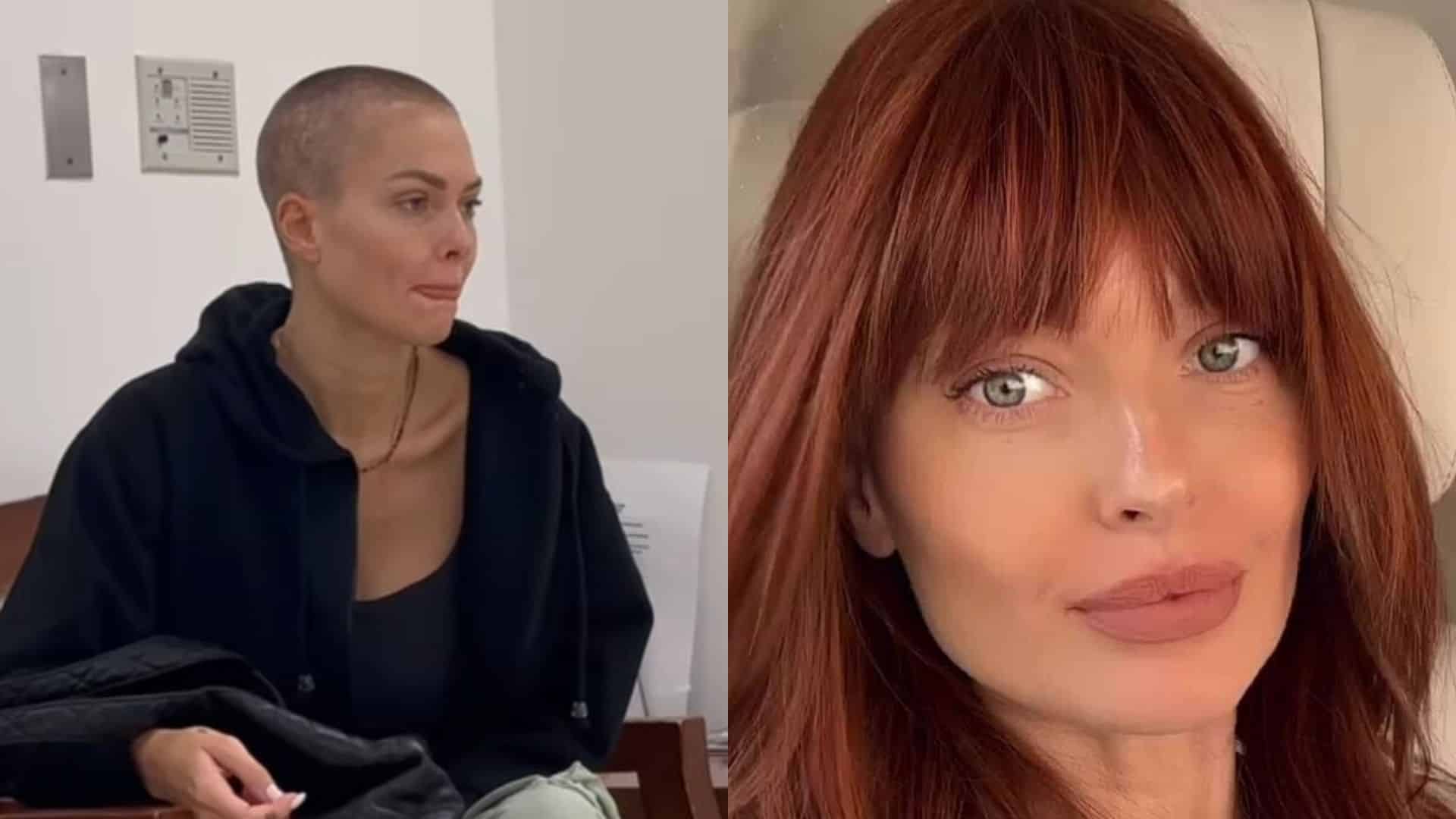 'J'ai quasi tout perdu' : Caroline Receveur se livre sur les effets secondaires de son traitement