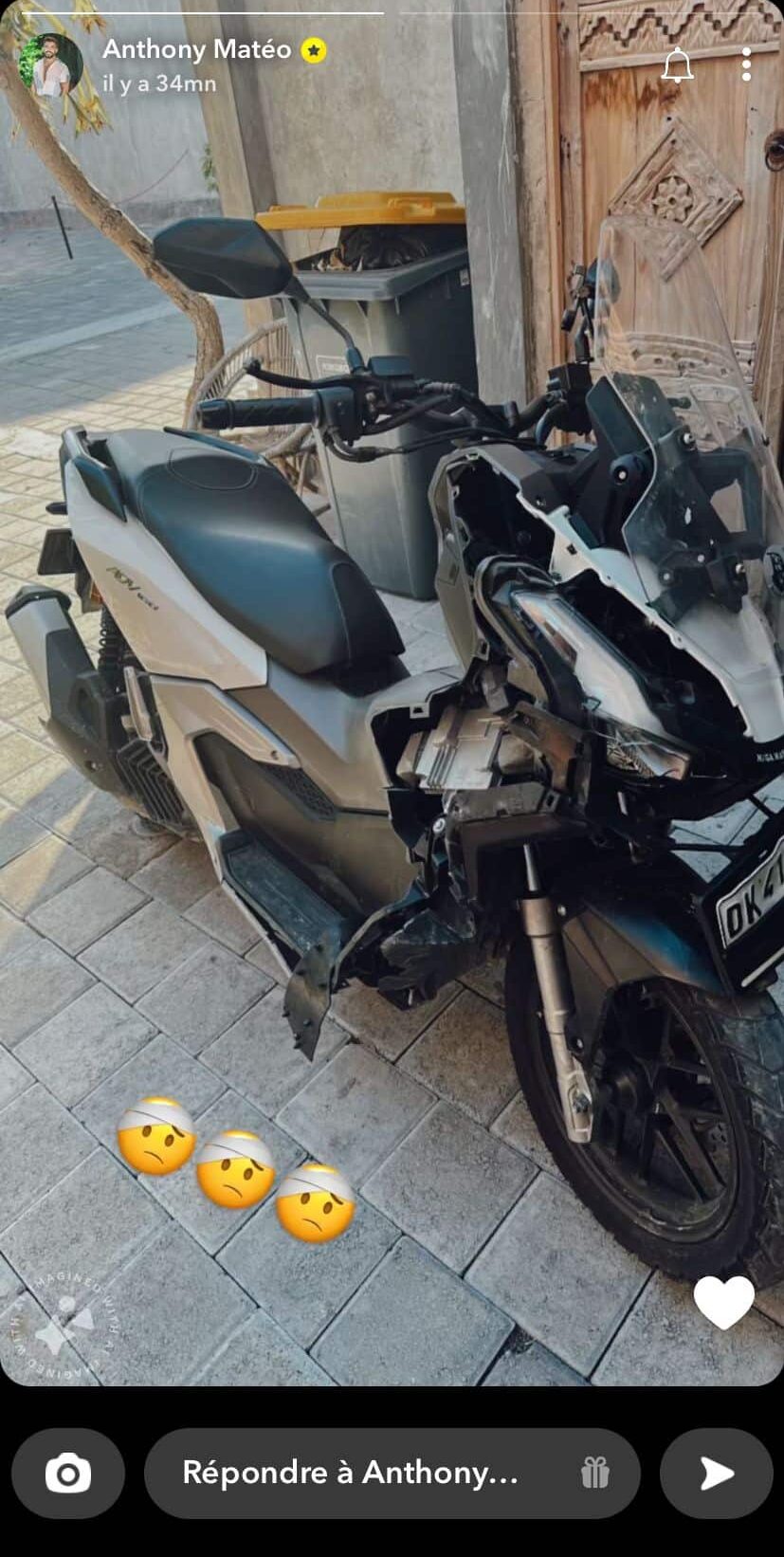 Anthony Matéo : après un accident de moto à Bali, il montre ses blessures