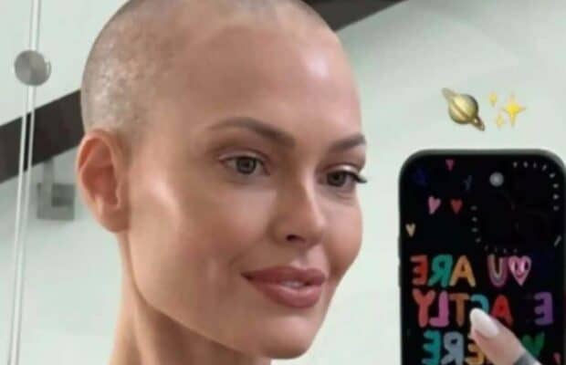 Caroline Receveur face au cancer : elle se confie sur les effets secondaires de son nouveau traitement