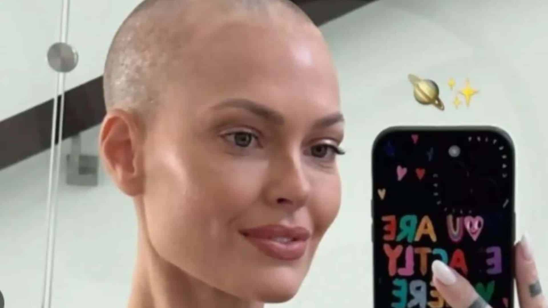 Caroline Receveur face au cancer : elle se confie sur les effets secondaires de son nouveau traitement