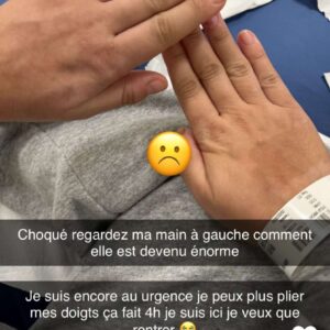 Fidji Ruiz enceinte : admise aux urgences, sa main a triplé de volume