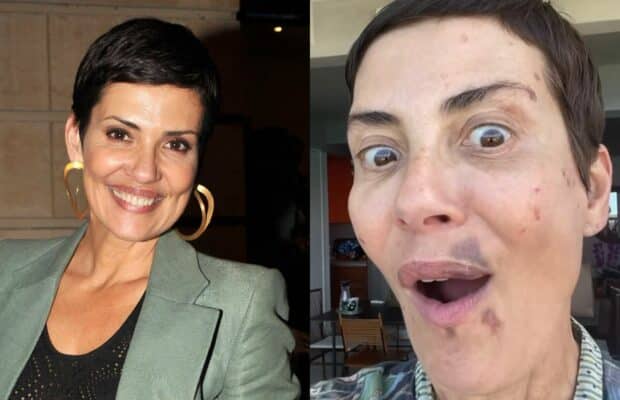 Cristina Cordula : elle se montre avec plusieurs hématomes au visage