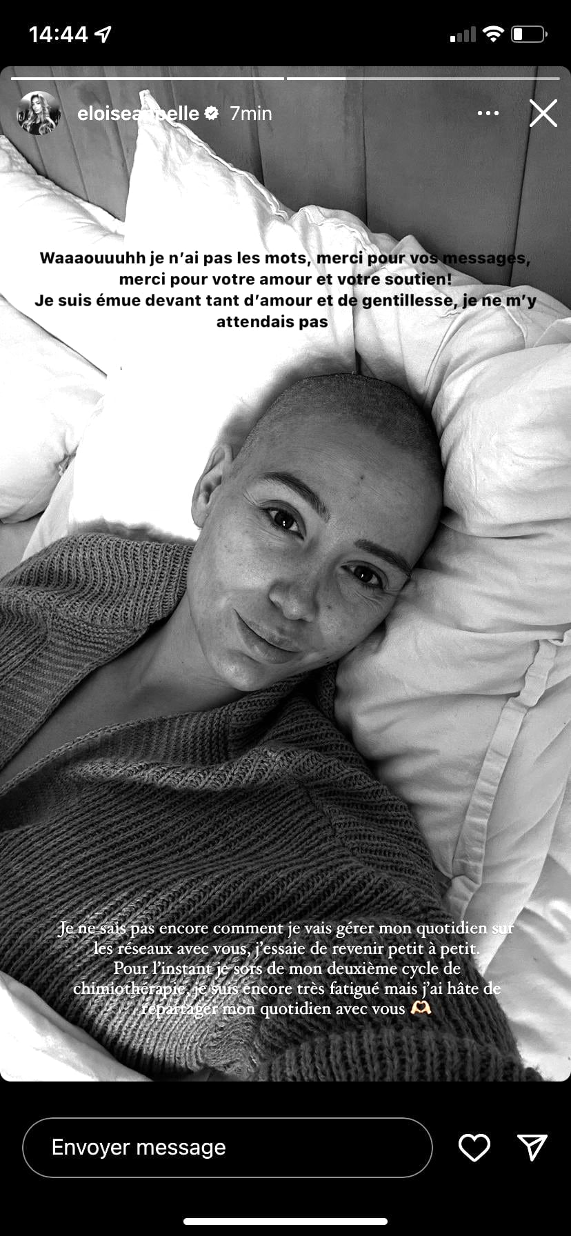 Eloïse Appelle : l'influenceuse prend la parole après l'annonce de son cancer du sein agressif