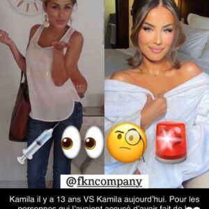 Kamila : accro à la chirurgie esthétique ? Une ancienne photo refait surface