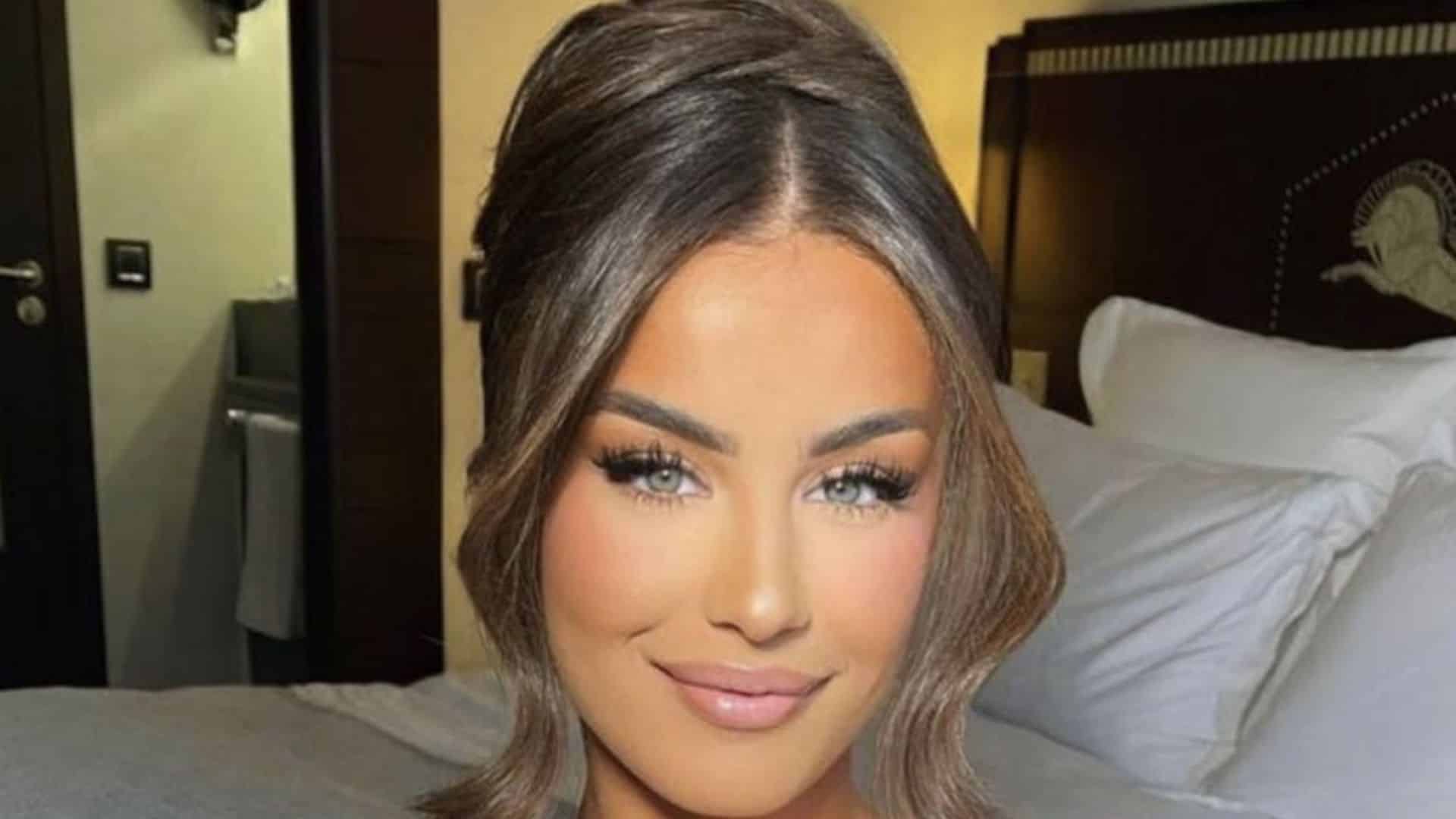 Kamila : accro à la chirurgie esthétique ? Une ancienne photo refait surface