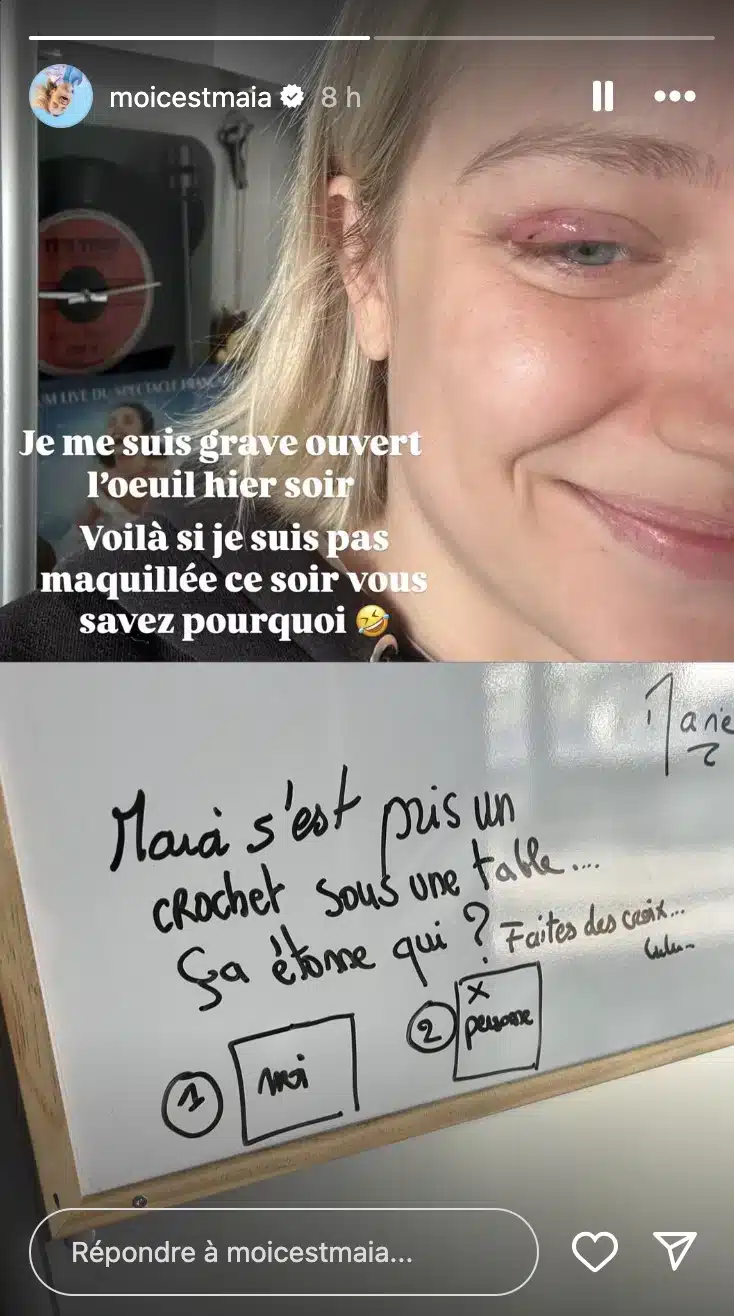 Maïa (Star Academy) : victime d'un accident, elle montre les images de son œil ouvert