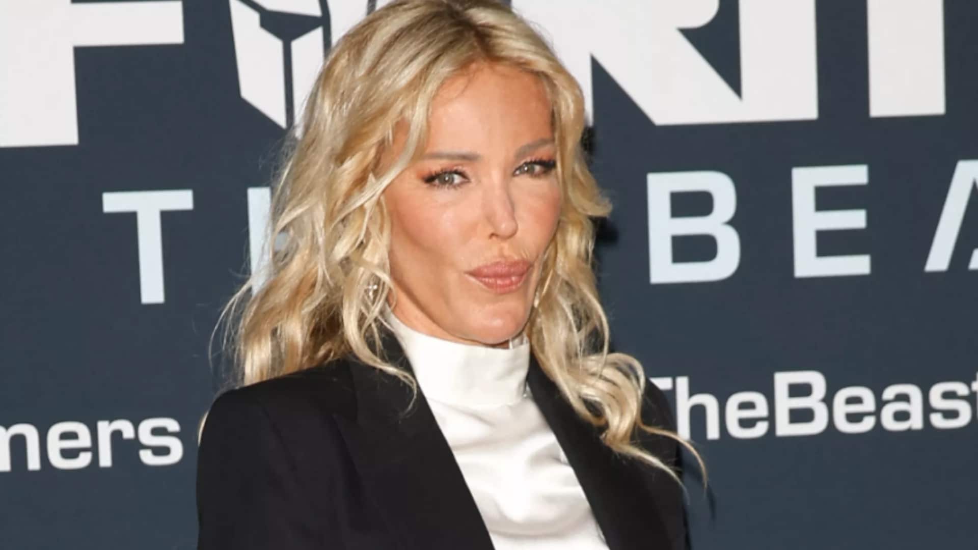 Ophélie Winter : "défigurée" après un cambriolage, elle réapparaît méconnaissable