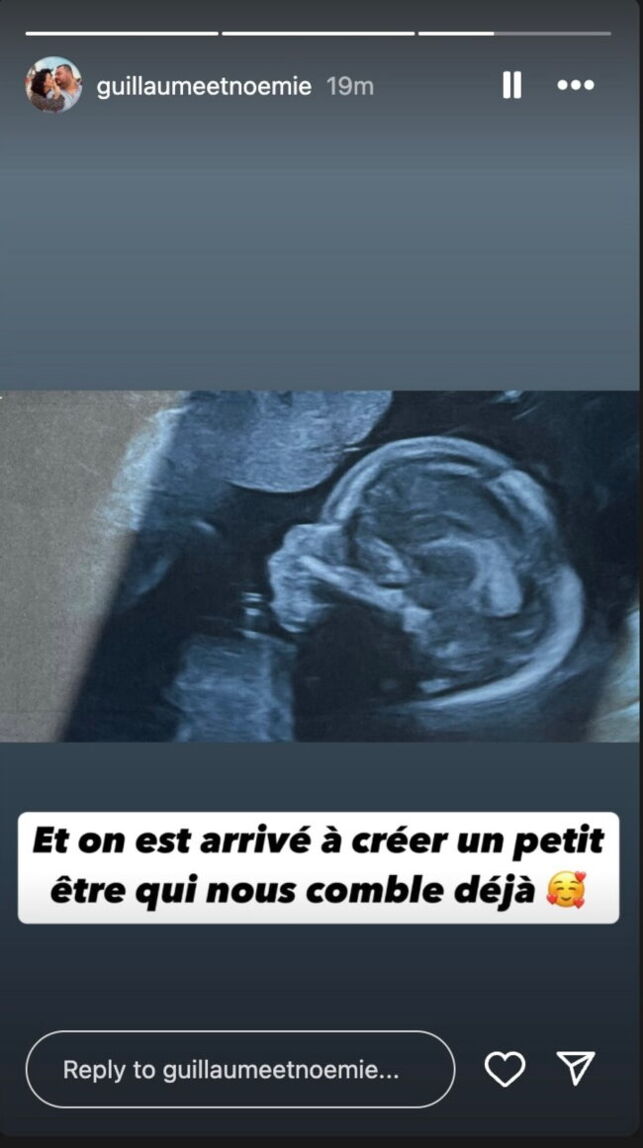 L’amour est dans le pré : un couple du programme attend son premier enfant