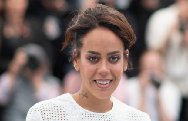 Amel Bent : elle arrive en plein concert en boîtant et brûlée au troisième degré