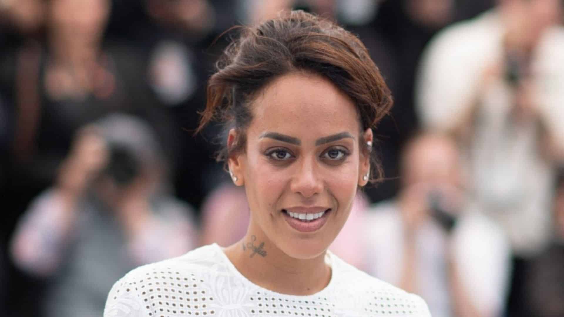 Amel Bent : elle arrive en plein concert en boîtant et brûlée au troisième degré