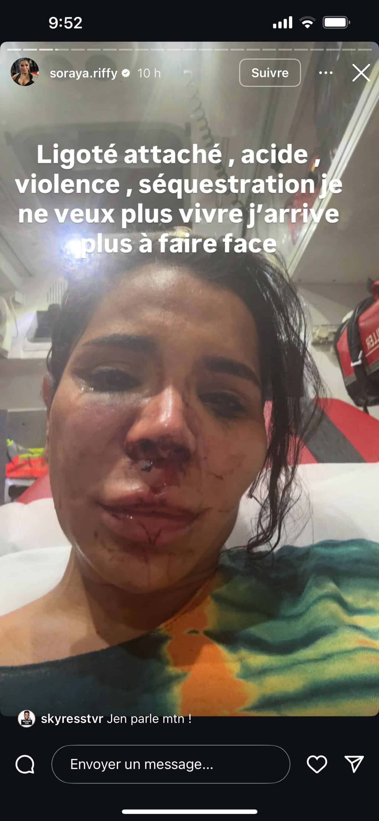 TPMP : une ancienne chroniqueuse révèle avoir été victime d’une agression