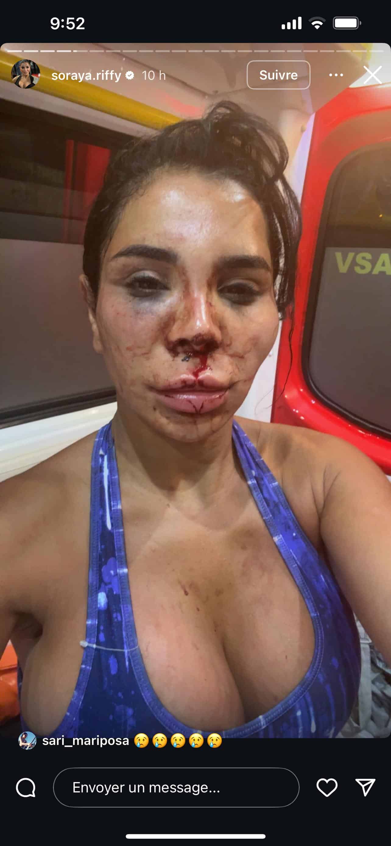 TPMP : une ancienne chroniqueuse révèle avoir été victime d’une agression